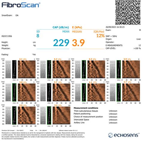 liver hardness test|fibroscan results chart.